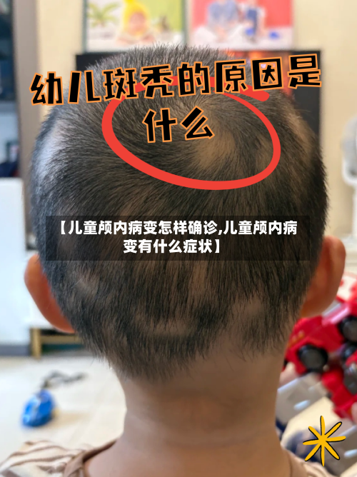 【儿童颅内病变怎样确诊,儿童颅内病变有什么症状】