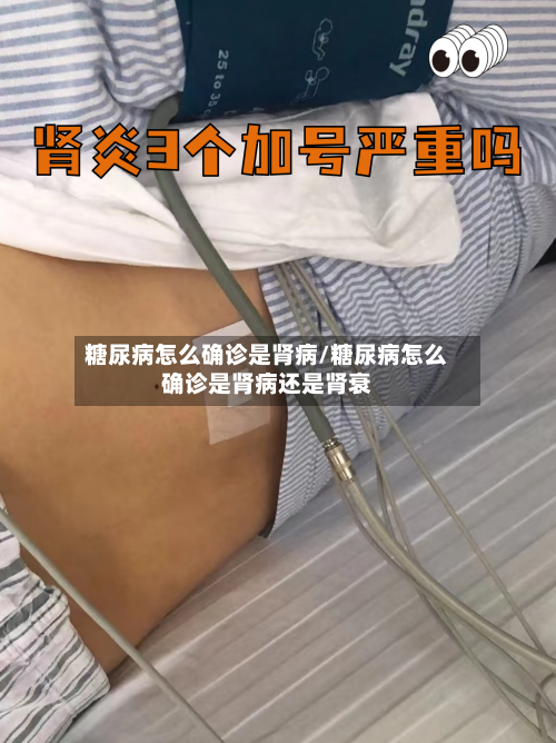 糖尿病怎么确诊是肾病/糖尿病怎么确诊是肾病还是肾衰-第2张图片